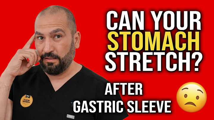 Can Your Stomach Stretch After Gastric Sleeve? 😟