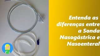 Entenda as Diferenças entre a Sonda Nasogástrica e a Sonda Nasoenteral