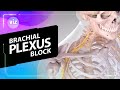 Brachial Plexus Block (3D Animation)