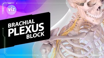 Brachiale plexusblokkade (3D-animatie)