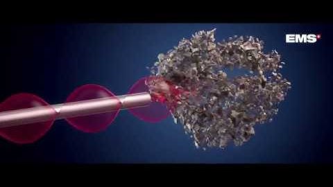 Swiss LithoClast® Trilogy -Plug-and-play lithotripter for fast, easy and safe PCNL treatments.