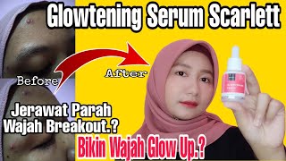 GLOWTENING SERUM SCARLETT UNTUK WAJAH GLOW UP