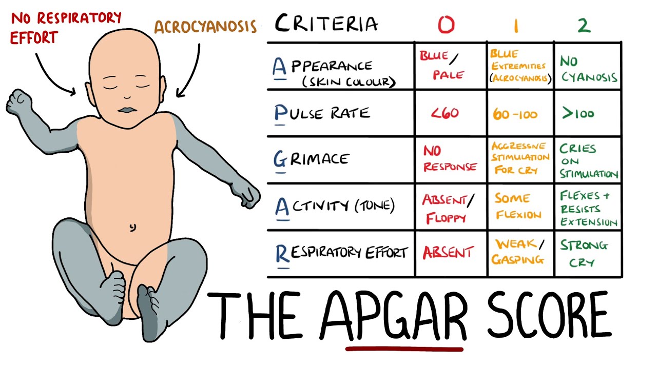 Apgar Score Made Easy Newborn Assessment Apgar Mnemonic Youtube