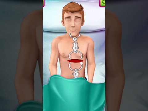 عملية قص عظم الصدر العاب افلام كارتونيه دكتور عمليات مضحك