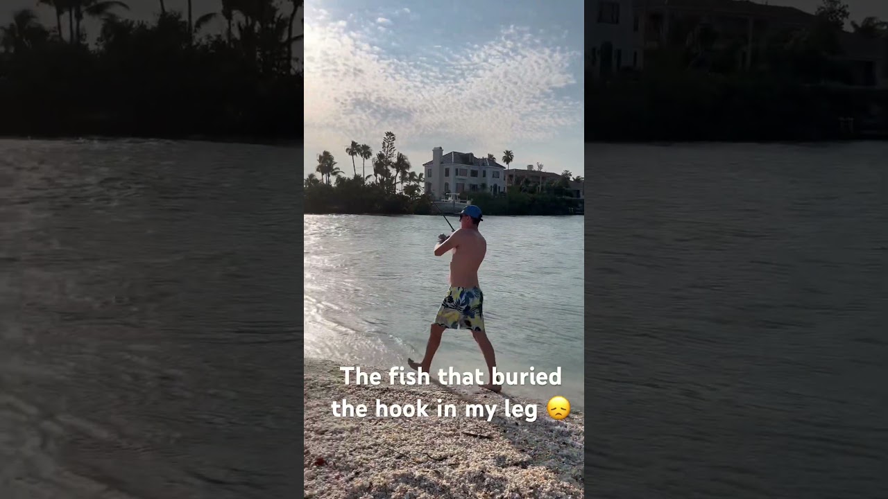 Snook spits the hook and buries a treble hook into my leg 🪝 🩸 🏥