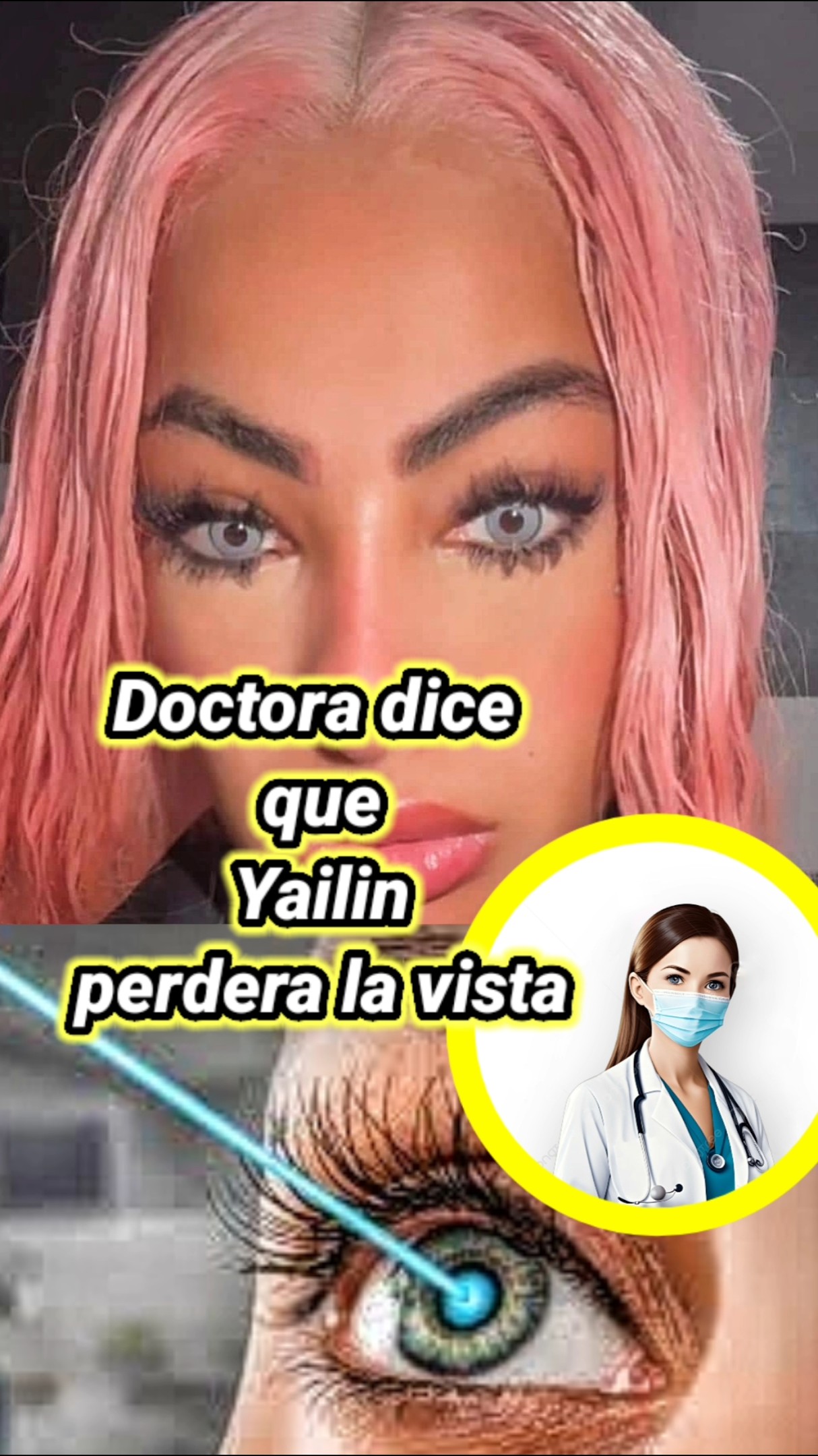 Doctora dice que Yailin perdera la vista. #yailinlamásviral