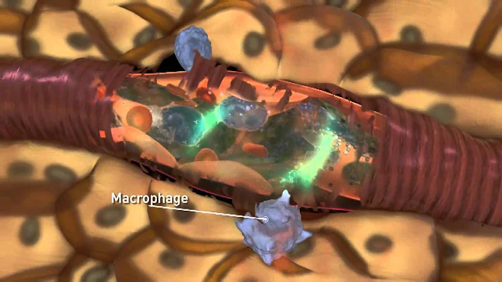 ANCA Pathogenesis