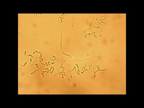 Videó: A Bacillus Megaterium Anyagcseréje Heparosan Bioszintézis Céljából Pasteurella Multocida Heparozán Szintázzal, PmHS2