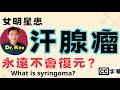 女明星有汗腺瘤永遠不會痊愈？syringoma: a never healing problem?