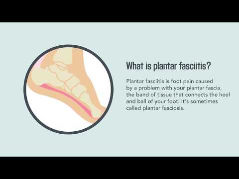 Video: Plantar Fasciitis: Orsaker, Symptom, Behandlingar Och Mer