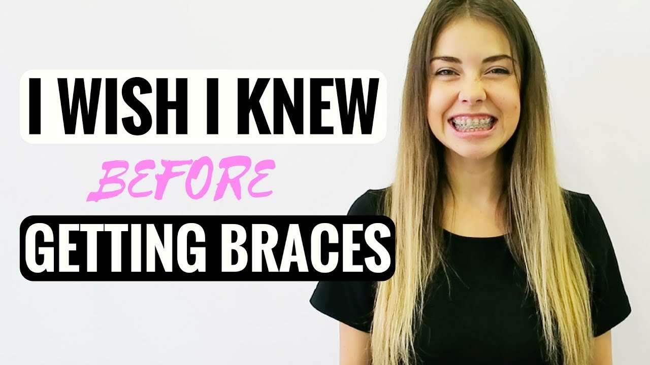 25 THINGS I WISH I KNEW BEFORE GETTING BRACES - WHAT YOU SHOULD KNOW ...