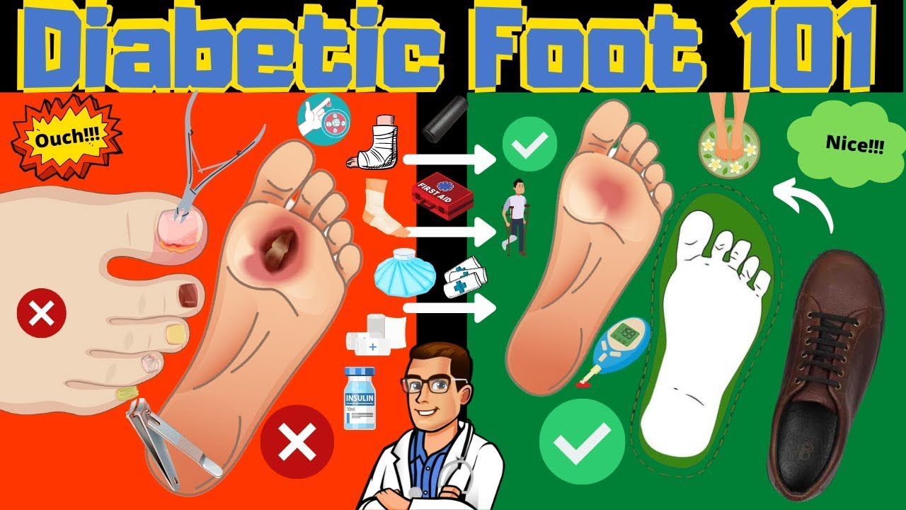 Diabetic Foot Care 101 [Diabetic Foot Pain: Podiatrist TREATMENT]