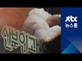 제왕절개 중 아기 얼굴 칼자국 담당의 상처 잘 아문다 제왕절개 중 아기 얼굴 칼자국 담당의 상처 잘 아문다