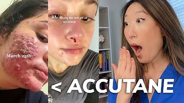 EVERYTHING you need to know about ACCUTANE: Dermatologist Explains