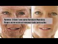 APENAS 2 DIAS!USE PARA REMOVER MANCHAS,RUGAS,ACNE