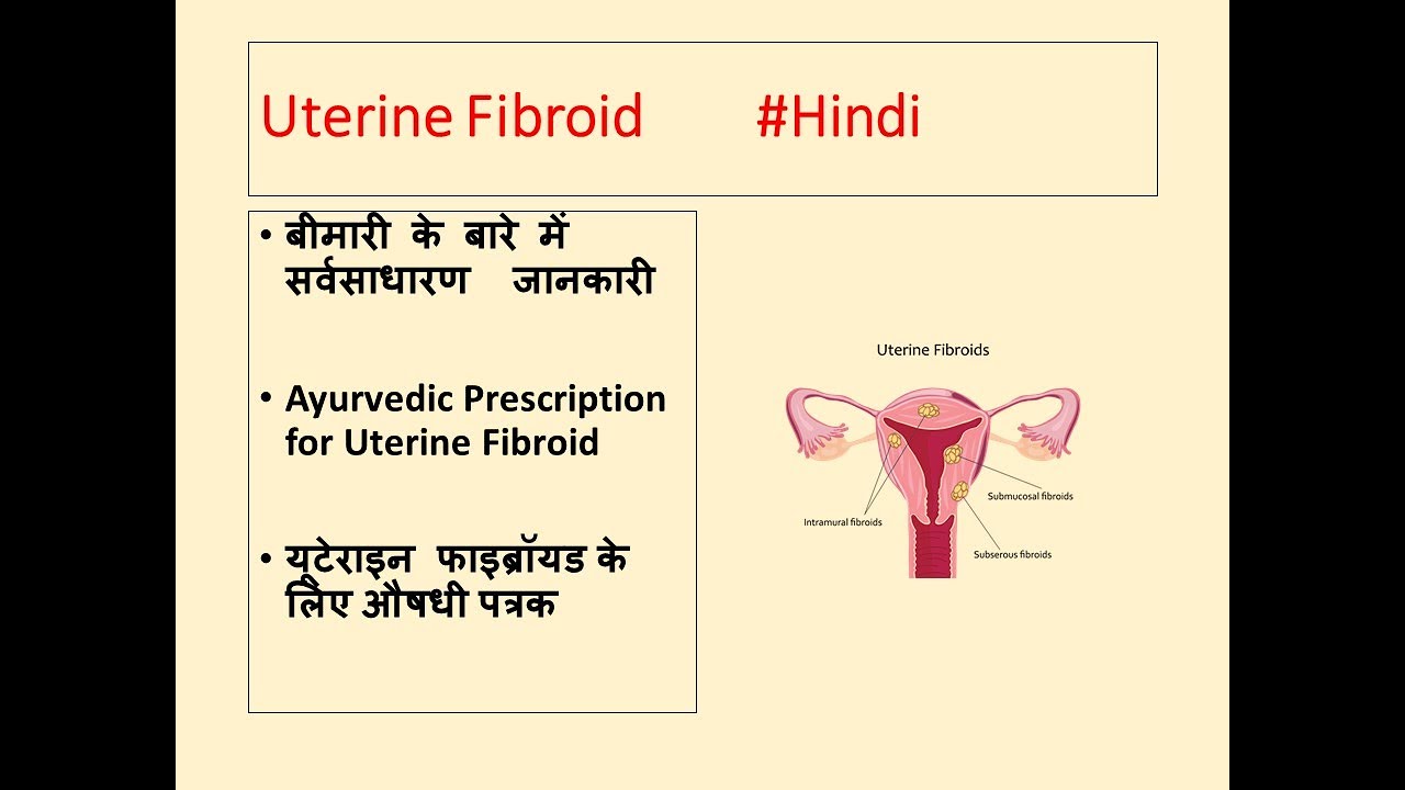 Uterine Fibroid l Ayurvedic Treatment for Uterine Fibroid l यूटेराइन