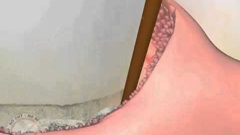 MDT Demo MPEG4 128kb