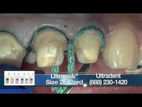 Replacing Crowns on Teeth #7-10 With BruxZir® Anterior