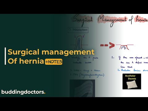 Hernia repair | surgical management of hernia lecture