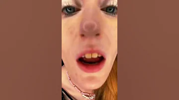 Yellowest Teeth In The World VS Orthodontist 