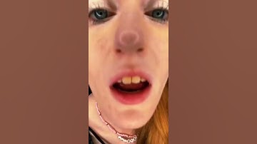 Thumbnail of Yellowest Teeth In The World VS Orthodontist