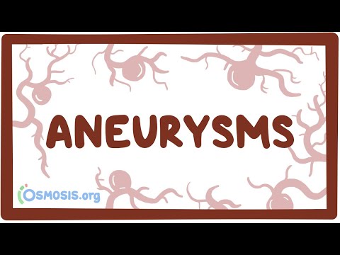 Aneurysms - causes, symptoms, diagnosis, treatment, pathology