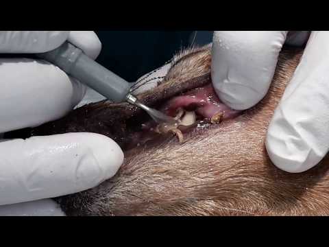 Zubni kamenac i plak, ultrazvučno uklanjanje