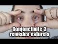 Conjonctivite  3 remdes naturels pour soulager vos yeux