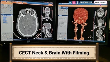 CECT NECK & BRAIN With Fliming| By Anis Qureshi