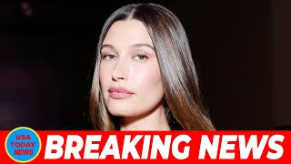 Hailey Bieber Reveals Bruised Eye After Baby Jack Accidentally Slams His Head Into Her Face