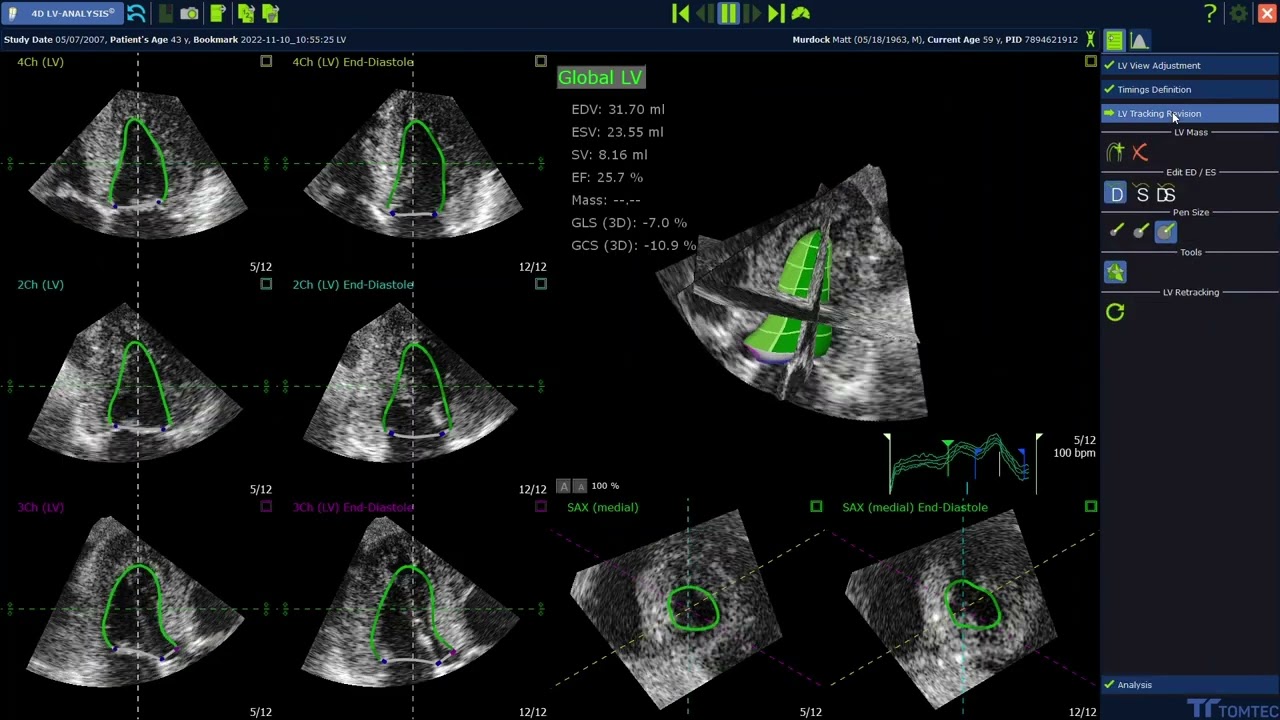 Enterprise Imaging for Cardiology - the Cardiology Imaging Health Record