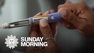 How Ozempic, other weightloss drugs are 'changing medicine'
