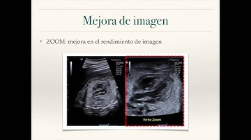 Alpinion: Nueva versión ECube15EX V3.1