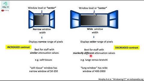 Window width and window level (CT) - simplified