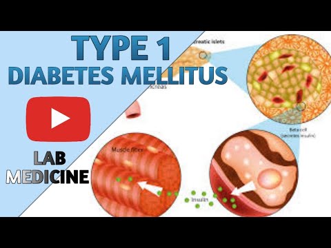 Type 1 Diabetes Mellitus in Easy | Chemical Pathology | Animated - YouTube