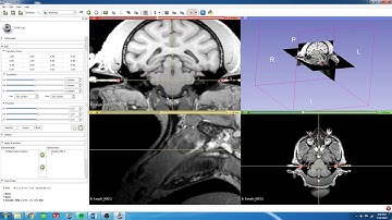 5.  3D Slicer - Rotate Fiducials for Stereotaxic Alignment
