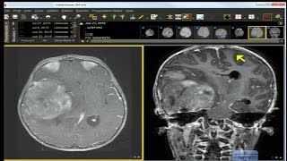 Neuro Imaging: Board and Recredentialing Review 8