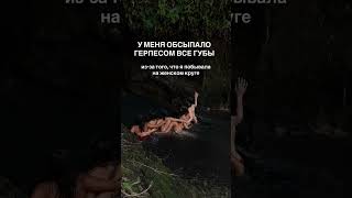 Герпес перед женским кругом