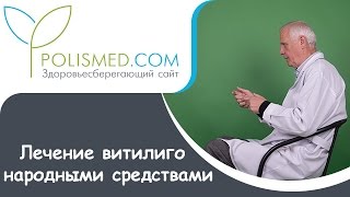 видео Витилиго – Лечение - Народные средства – Причины болезни – Как лечить пятна витилиго