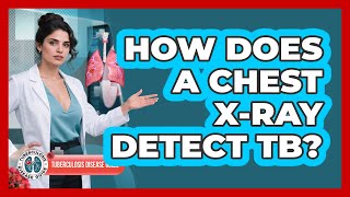 How Does a Chest X-ray Detect TB?
