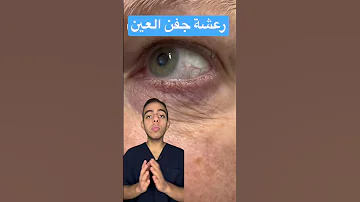 رعشة جفن العين واسبابها Short طب Medicine 