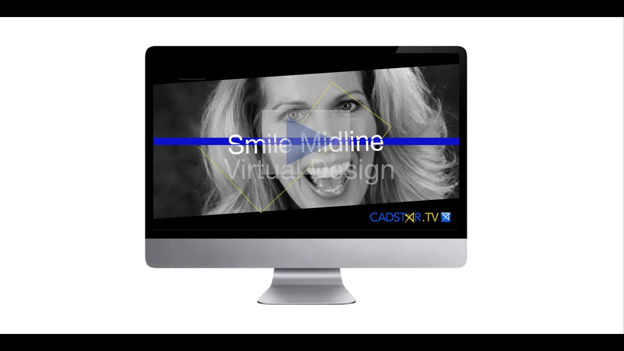 Mastering the Maxillary Midline in the CEREC Software