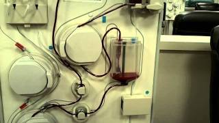 Plasma Machine