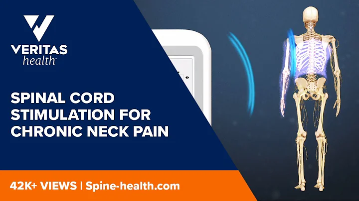 Spinal Cord Stimulation for Chronic Neck Pain