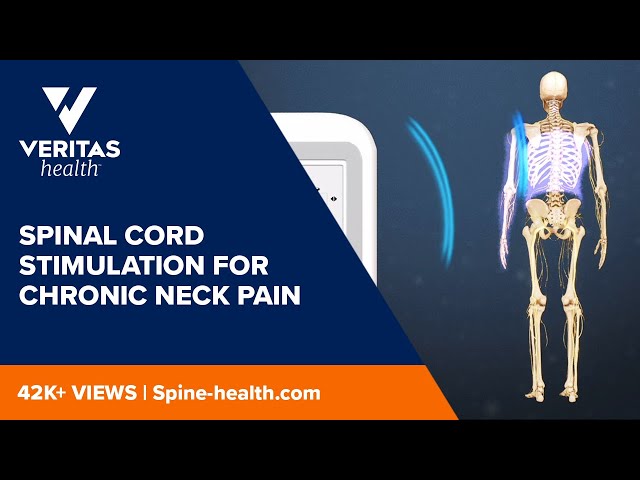 Spinal Cord Stimulation for Chronic Back Pain Video