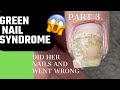 She did her nails the wrong way and got the Green nail syndrome 😱 | reply a comment