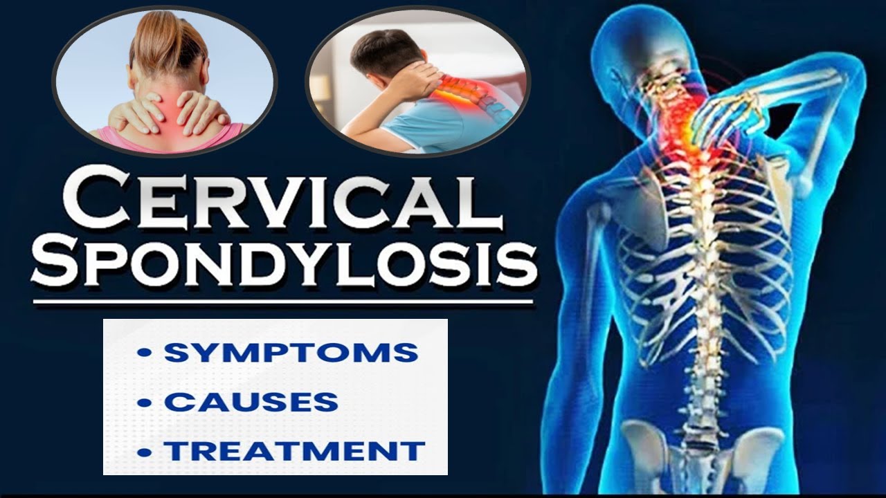 Cervical - Causes and Treatment with Tiens Products