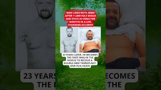 SHOCK ACCIDENT: He lost both arms to 11,000 volts… 23 years later, the impossible happened Details