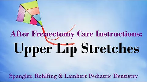 After Frenectomy Care Instructions: Upper Lip Stretch