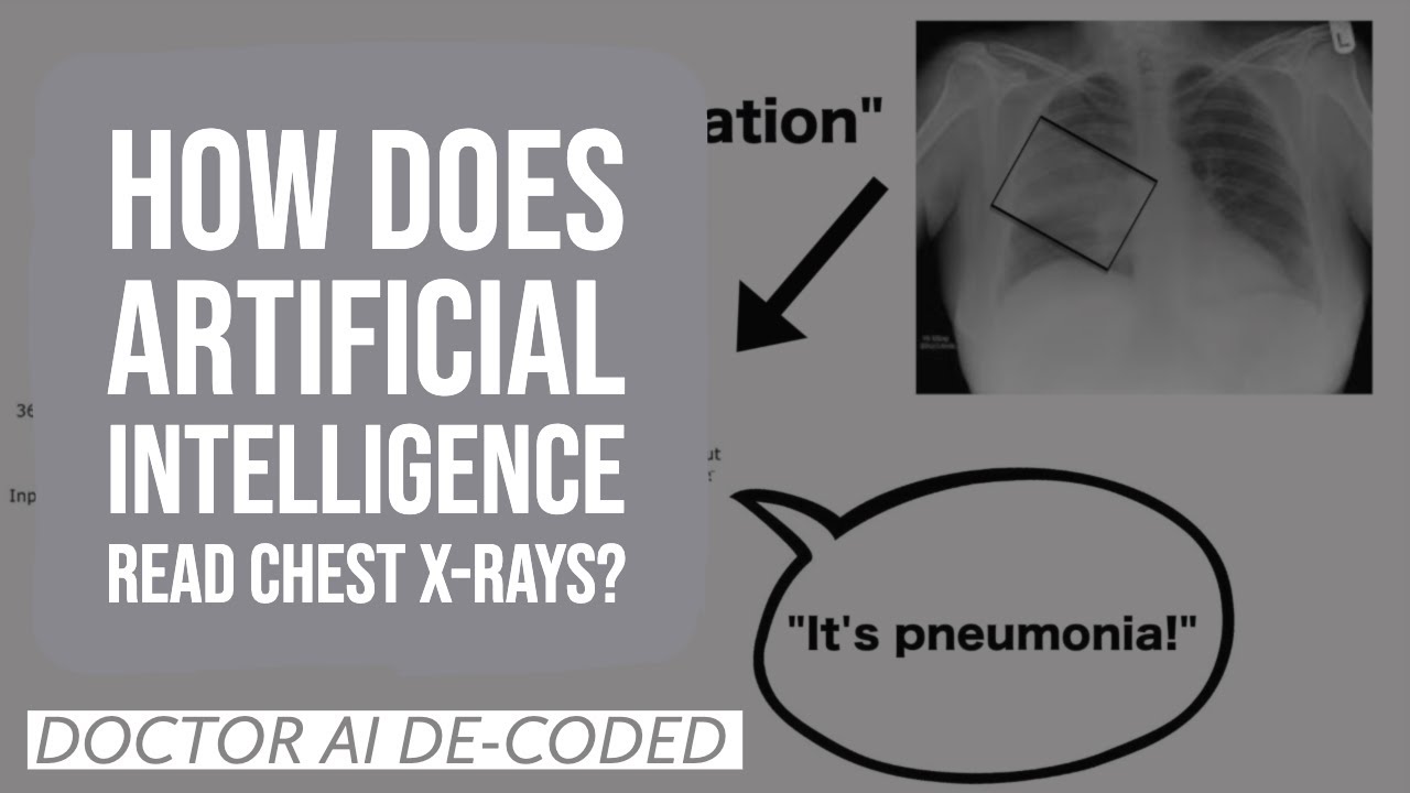 How does artificial intelligence read chest X-rays? | Dr AI De-Coded